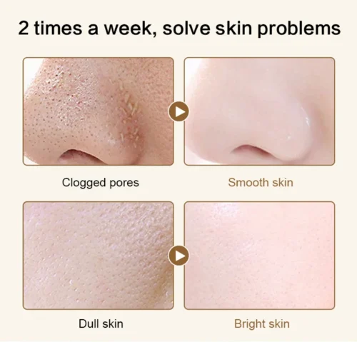 C8xbErugkpWskZYRsN8ZOQ6wzhopd99rs6kNVPAh Masque visage anti-rides au peptide de venin de serpent au rétinol